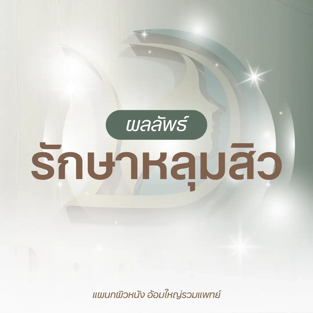 ผลลัพธ์รักษาหลุมสิว หมอนัท อ้อมใหญ่รวมแพทย์