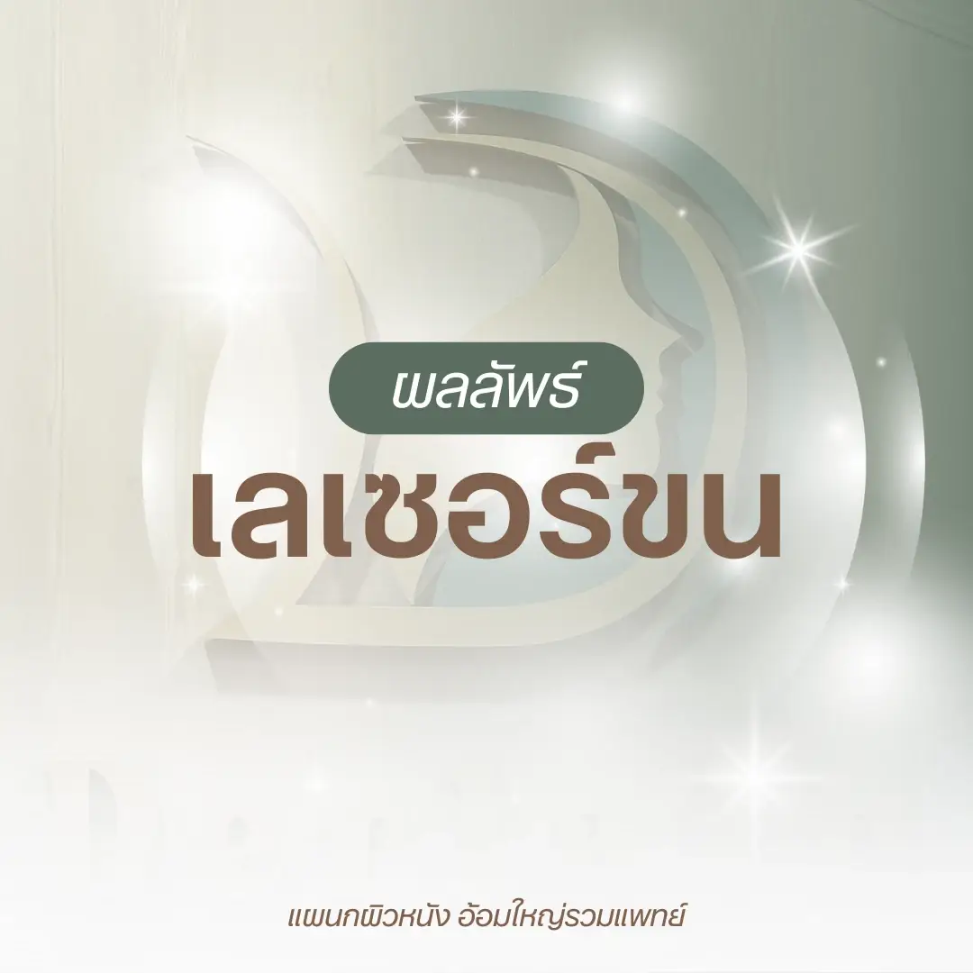 ผลลัพธ์เลเซอร์กำจัดขนถาวร หมอนัท อ้อมใหญ่รวมแพทย์