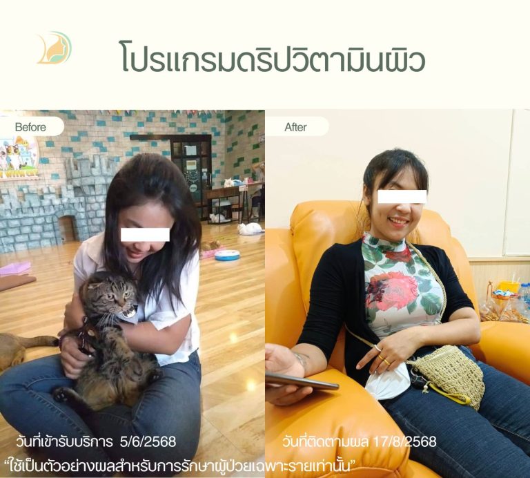 บริการเปิดเส้นเลือดดำสำหรับดริปวิตามิน โดยพยาบาลวิชาชีพ คลินิกอ้อมใหญ่รวมแพทย์ แผนกผิวหนัง