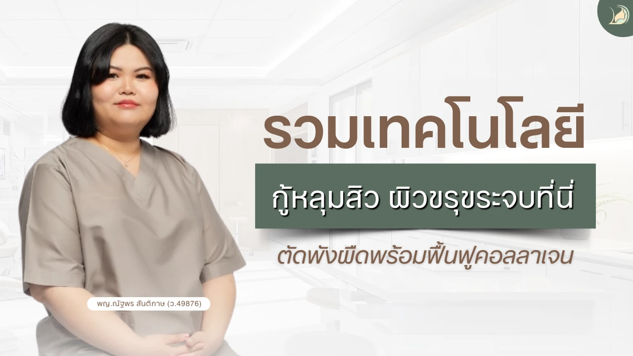รวมเทคโนโลยีกู้หลุมสิวปี 2026 ตัดพังผืดพร้อมฟื้นฟูคอลลาเจน แผนกผิวหนัง อ้อมใหญ่รวมแพทย์